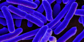 A purple, closeup photo of microscopic E. coli bacteria.